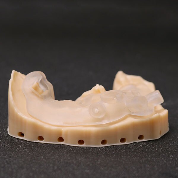 Modelo impreso en 3D dental
